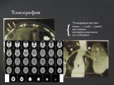 Томография (от греч. tomos — слой) — метод послойного рентгенологического исследования. Томография