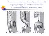 Схема пластики дефекта большеберцовой кости (К) участком мышцы (М) на проксимально (б) и дистально (в) расположенном основании С – питающий мышцу сосудистый пучок