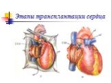 Пластическая хирургия Слайд: 39