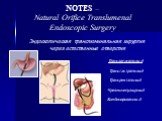NOTES – Natural Orifice Translumenal Endoscopic Surgery. Эндоскопическая транслюминальная хирургия через естественные отверстия. Трансгастральный Трансвагинальный Трансректальный Чрезмочепузырный Комбинированный