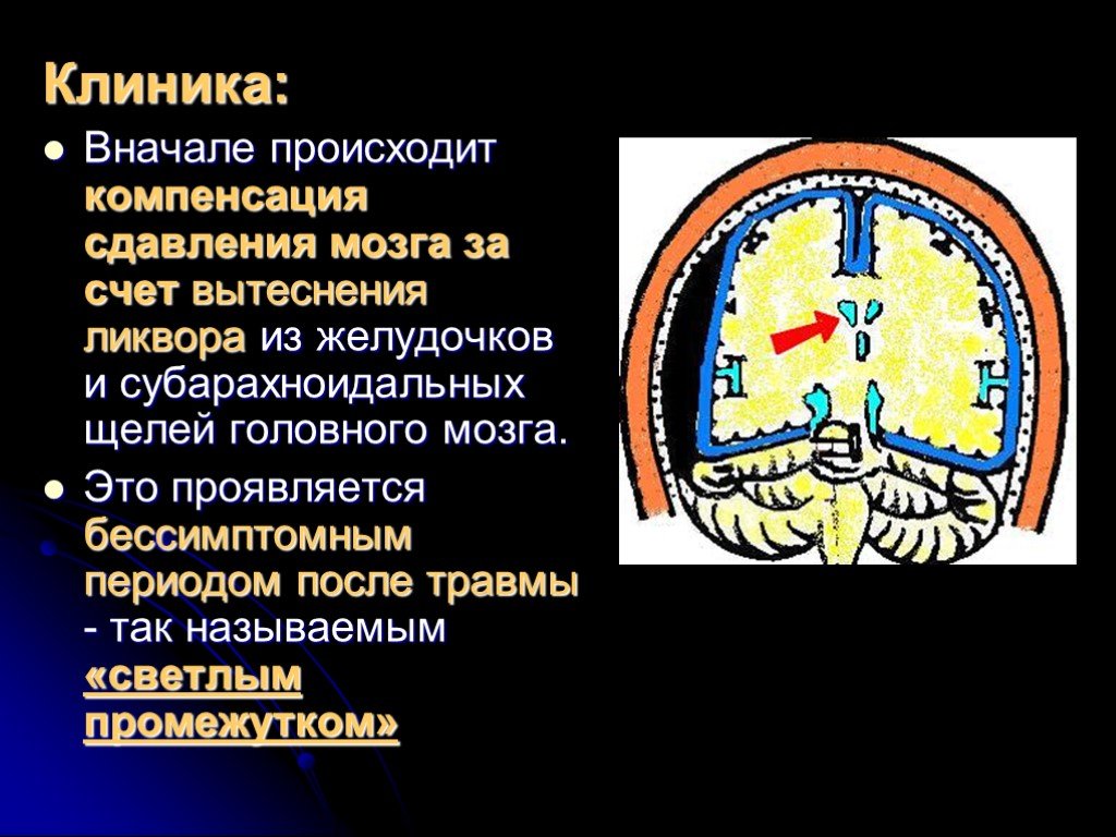 Сначала происходит. ЧМТ сдавление головного мозга. Сдавление головного мозга клиника. Черепно-мозговая травма лекция. Сдавление головного мозга патогенез.