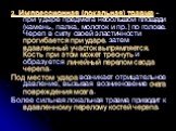 2. Импрессионная (локальная) травма - при ударе предмета небольшой площади (камень, палка, молоток и пр.) по голове. Череп в силу своей эластичности прогибается при ударе, затем вдавленный участок выпрямляется. Кость при этом может треснуть и образуется линейный перелом свода черепа. Под местом удар