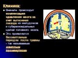 Клиника: Вначале происходит компенсация сдавления мозга за счет вытеснения ликвора из желудочков и субарахноидальных щелей головного мозга. Это проявляется бессимптомным периодом после травмы - так называемым «светлым промежутком»