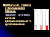 Люмбальная пункция и исследование ликвора. Позволяет установить наличие субарахноидального кровоизлияния.