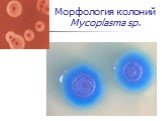 Морфология колоний Mycoplasma sp.