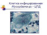 Клетка инфицированная Mycoplasma sp. - ЦПД