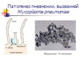 Патогенез пневмонии, вызванной Mycoplasma pneumoniae. Микроколония M. pneumoniae