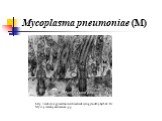 Mycoplasma pneumoniae (M). http://embryology.med.unsw.edu.au/embryology/index.php?title=File:Mycoplasma-pneumoniae.jpg