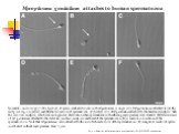 Mycoplasma genitalium attaches to human spermatozoa. Nomarski microscopy (×100 objective) of sperm incubated in vitro with M.genitalium. A single cell of M.genitaliumis attached to (A) the midpiece region (arrow) and (B) the tail (arrow) of spermatozoa. (C) Several cells of M.genitalium attached to 