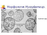 Морфология Mycoplasma sp. 0,15-0,7 мкм