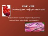 ИБС. ОКС Стенокардия, инфаркт миокарда. Всероссийское научное общество кардиологов Национальные клинические рекомендации