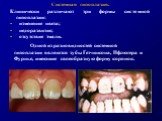 Системная гипоплазия. Клинически различают три формы системной гипоплазии: изменение цвета; недоразвитие; отсутствие эмали. Одной из разновидностей системной гипоплазии являются зубы Гетчинсона, Пфлюгера и Фурнье, имеющие своеобразную форму коронок.