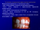 Аутосомно-доминантная шероховатая гипоплазия Поражаются временные и постоянные зубы: цвет зубов изменен от белого до желтовато-белого; эмаль зубов твердая с шероховатой, зернистой поверхностью; эмаль может откалываться от дентина; толщина эмали составляет от 1/1 до 1/8 толщины нормальной эмали; в от