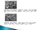 Микроскопический снимок конвенциональной металлокерамики (увеличение: х 1000). Видно, что кристаллы лейцита размещаются в пучках диаметром приблизительно 30 |JM. Трещины напряжения часто образуются вокруг этих пучков из-за большой разницы коэффициентов теплового расширения лейцитной и стекло-фазы. М
