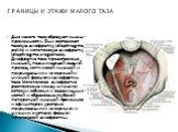 Дно малого таза образуют мышцы промежности. Они составляют тазовую диафрагму (diaphragma pelvis) и мочеполовую диафрагму (diaphragma urogenitale). Диафрагма таза представлена мышцей, поднимающей задний проход, копчиковой мышцей и покрывающими их верхней и нижней фасциями диафрагмы таза. Мочеполовая 
