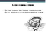 Ножное предлежание. В случае ножного предлежания родоразрешение обычно проводится посредством кесарева сечения