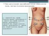 5 — передний вид, первая позиция, тазовое предлежание; 6 — задний вид, первая позиция, тазовое предлежание, 7 — передний вид, вторая позиция, тазовое предлежание; 8 — задний вид, вторая позиция, тазовое предлежание". При аускультации сердцебиение плода определяется выше, чем при головном предле