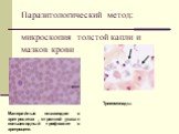 Паразитологический метод: микроскопия толстой капли и мазков крови. Малярийные плазмодии в эритроцитах , стрелкой указан кольцевидный трофозоит в эритроците. Трихомонады.