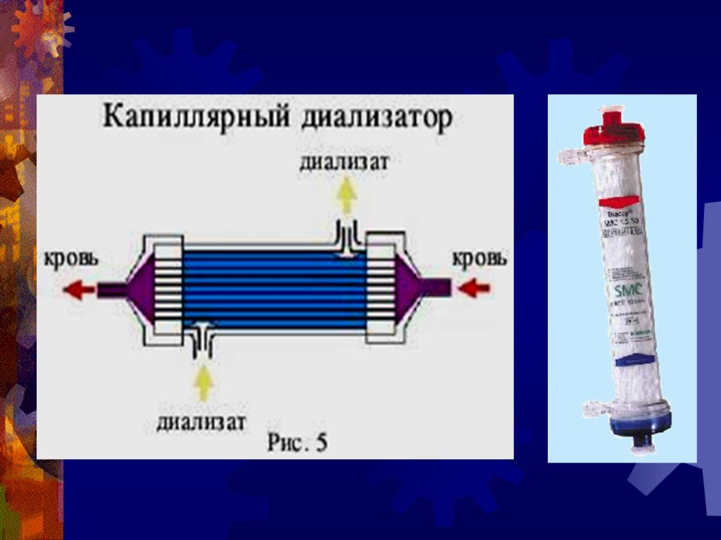 Диализатор. Пластинчатые (дисковые) диализаторы.. Капиллярный диализатор. Схема диализатора для гемодиализа. Мембрана диализатора.