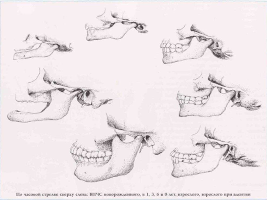 Мыщелки челюсти. Возрастные изменения ВНЧС. ВНЧС костные структуры.