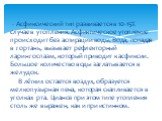 - Асфиксический тип развивается в 10-15% случаев утопления. Асфиктическое утопление происходит без аспирации воды. Вода, попадая в гортань, вызывает рефлекторный ларингоспазм, который приводит к асфиксии. Большое количество воды заглатывается в желудок. В лёгких остается воздух, образуется мелкопузы