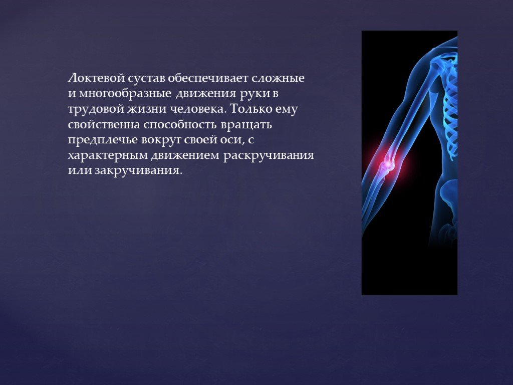 Движение характерно. Прочность суставов достигается. Движение в любом суставе обеспечивается. Для естественных движений характерно. Движение в руке обеспечивают.