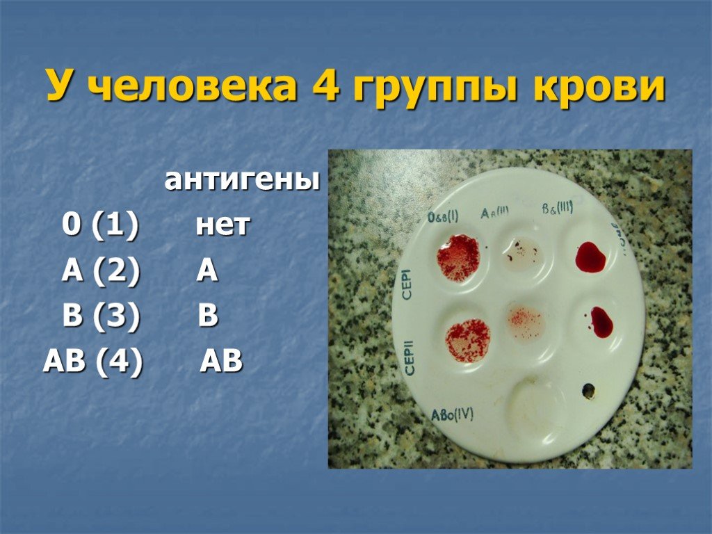 Какая группа крови в россии. Группа крови. Самая распространенная группа крови. Кровь группы крови. Редкие типы крови.