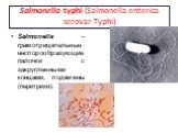 Salmonella typhi (Salmonella enterica serovar Typhi). Salmonella – грамотрицательные неспорообразующиепалочки с закругленными концами, подвижны (перитрихи).