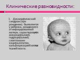 Клинические разновидности: 1. Дизморфический синдром (при рождении). Выявляется у ребенка, рожденного от инфицированной матери, характеризуется микроцефалией, гидроцефалией, симптомами энцефалопатии, кальфицикацией мягких тканей мозга.