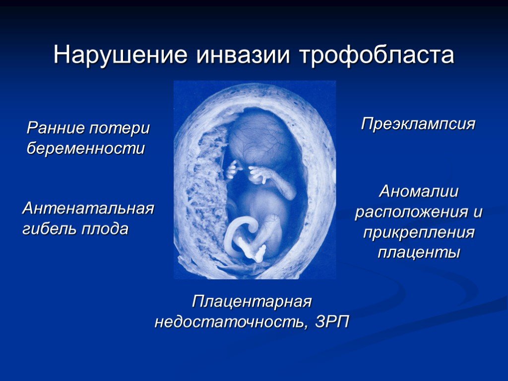 Беременность замершая симптомы признаки на раннем сроке. Инвазия трофобласта. Патологии развития плода. Аномалии развития эмбриона.