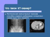 Что такое КТ сканер? Рентгеновский компьютерный томограф способен создавать изображения поперечных срезов через тело пациента