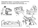 Поворачивание пациента и размещение его в положении на боку Выполняется на кровати с изменяющейся высотой. (выполняет одна сестра, пациент может помочь) (рис. 2.39)