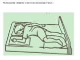 Расположение пациента в постели в положении Симса