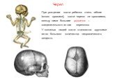 При рождении кости ребенка очень гибкие (много органики), кости черепа не сросшиеся, между ними большие роднички – соединительнотканная перепонка. У пожилых людей кости становятся хрупкими из-за большого количества неорганических веществ.