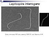 Leptospira interrogans. Длина лептоспир 6-20 мкм, диаметр 0,06-0,15 мкм. Завитков 12-18