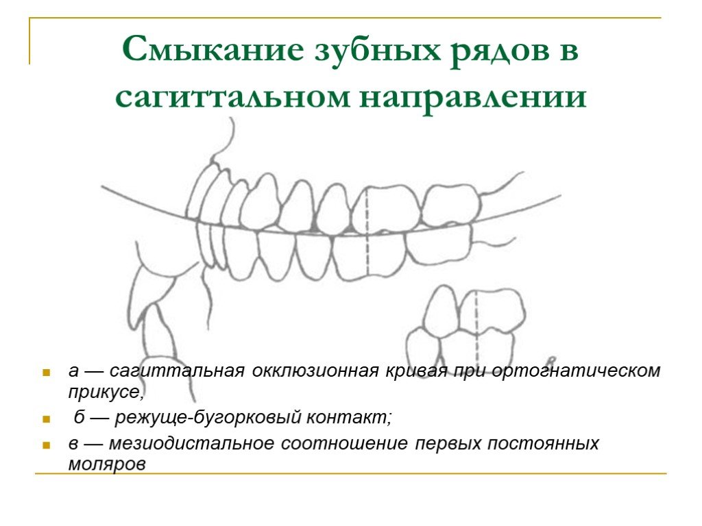 Вид смыкания зубных рядов