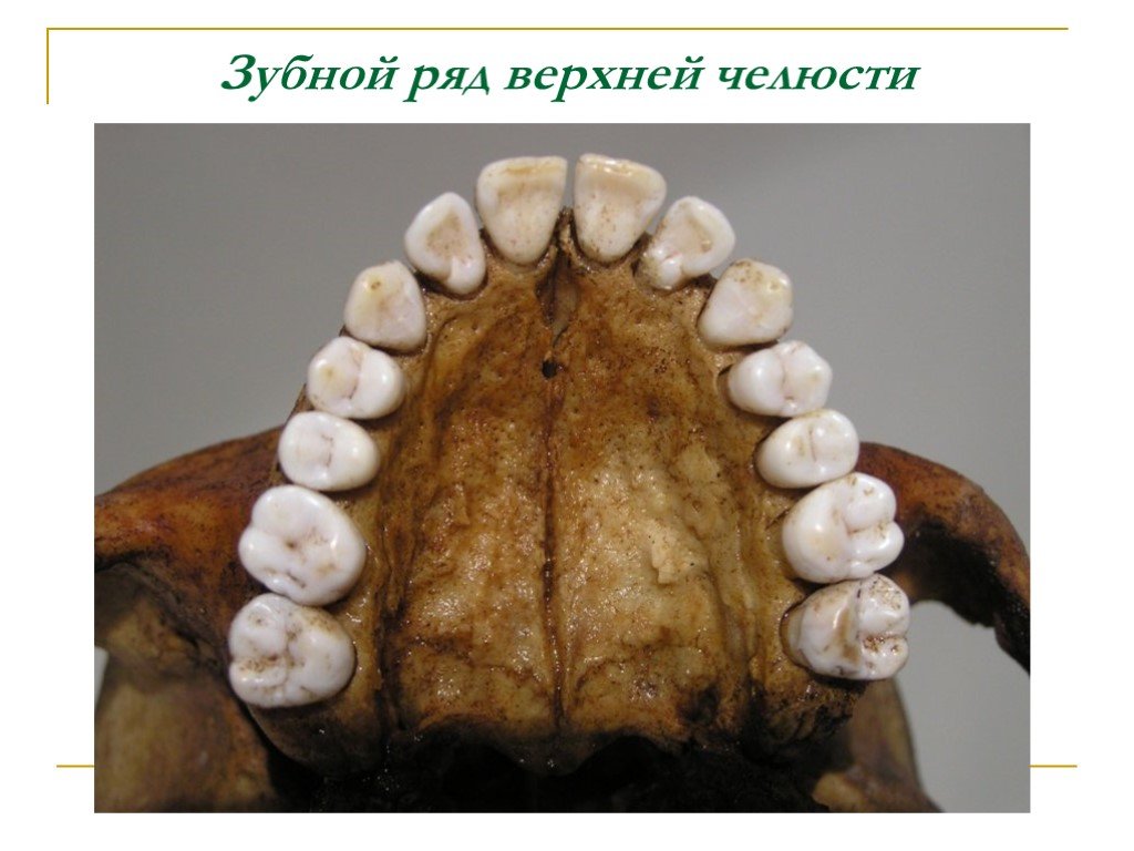 Верхний ряд. Зубной ряд верхней челюсти. Зубы человека верхняя челюсть.