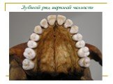 Зубной ряд верхней челюсти