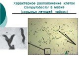 Характерное расположение клеток Campylobacter в мазке («крылья летящей чайки»)