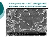 Campylobacter fetus – возбудитель внекишечного кампилобактериоза