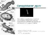 Campylobacter jejuni. EM at different magnifications (A and B) of cells of strain G1 treated with Alcian blue. Capsulated cells with fibrilla-like structures are also shown (C). CA, capsule; F, fibrillae. Karlyshev AV, McCrossan MV, Wren BW. Demonstration of polysaccharide capsule in Campylobacter j