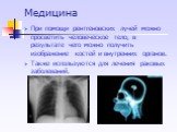 Медицина. При помощи рентгеновских лучей можно просветить человеческое тело, в результате чего можно получить изображение костей и внутренних органов. Также используются для лечения раковых заболеваний.