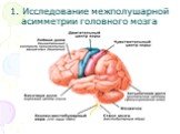 1. Исследование межполушарной асимметрии головного мозга
