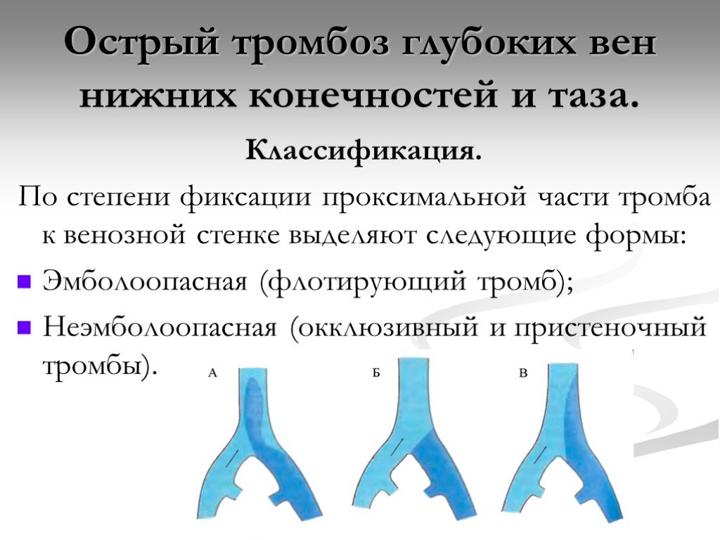 Формы тромбозов. Классификация тромбозов вен нижних конечностей. Тромбоз глубоких вен нижних конечностей классификация. Тромбофлебит глубоких вен нижних конечностей классификация. Острый тромбоз нижних конечностей классификация.