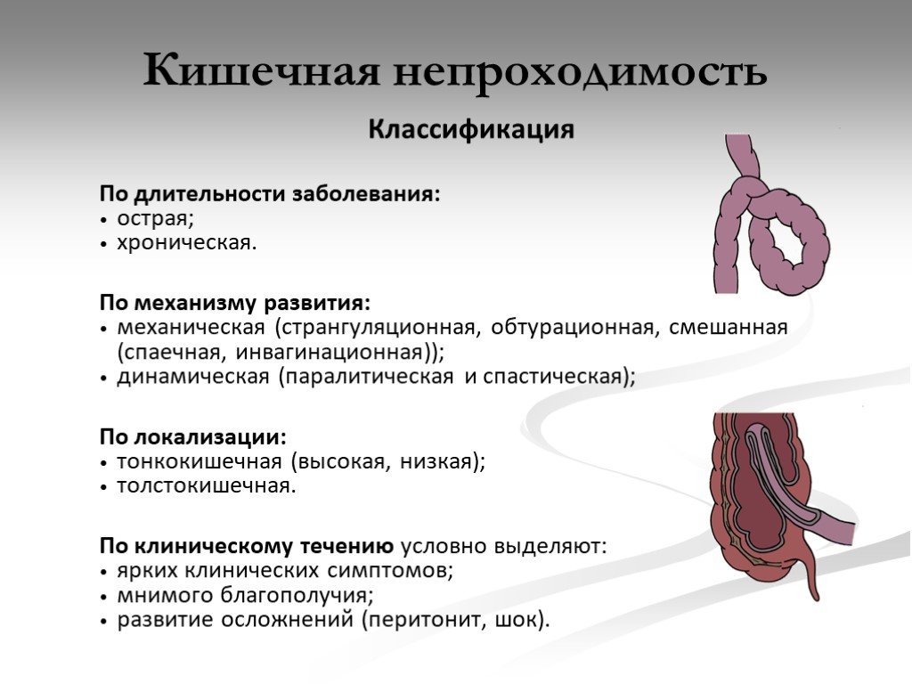 Колика кишечника симптомы лечение