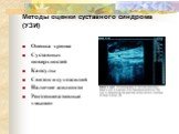 Методы оценки суставного синдрома (УЗИ). Оценка хряща Суставных поверхностей Капсулы Связок и сухожилий Наличие жидкости Рентгеннегативные «мыши»