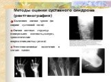 Методы оценки суставного синдрома (рентгенография). Косвенная оценка хряща (по ширине суставной щели) Оценка костных структур (минеральная плотность,склероз, травматические повреждения,кисты,эрозии) Рентгенпозитивные включения в мягких тканях