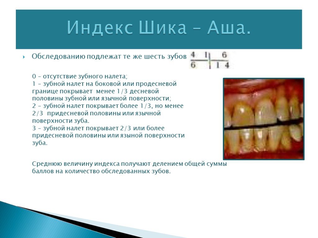 Оценка состояния полости рта. Гигиенические индексы для определения зубного налета. Зубной налет индекс гигиены. Стоматологические индексы гигиены полости рта.