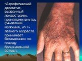 Атрофический дерматит, вызванный лекарствами, принятыми внутрь (54-летний мужчина, из 7-летнего возраста принимает бетаметазон по поводу бронхиальной астмы).