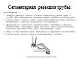 Этапы операции 1. Санируют брюшную полость и полость малого таза, удаляют кровь и сгустки. При необходимости рассекают спайки в области маточной трубы. 2. Участок трубы с плодным яйцом захватывают атравматическим зажимом и приподнимают вверх для визуализации мезосальпинкса. 3. Проксимальнее и дистал